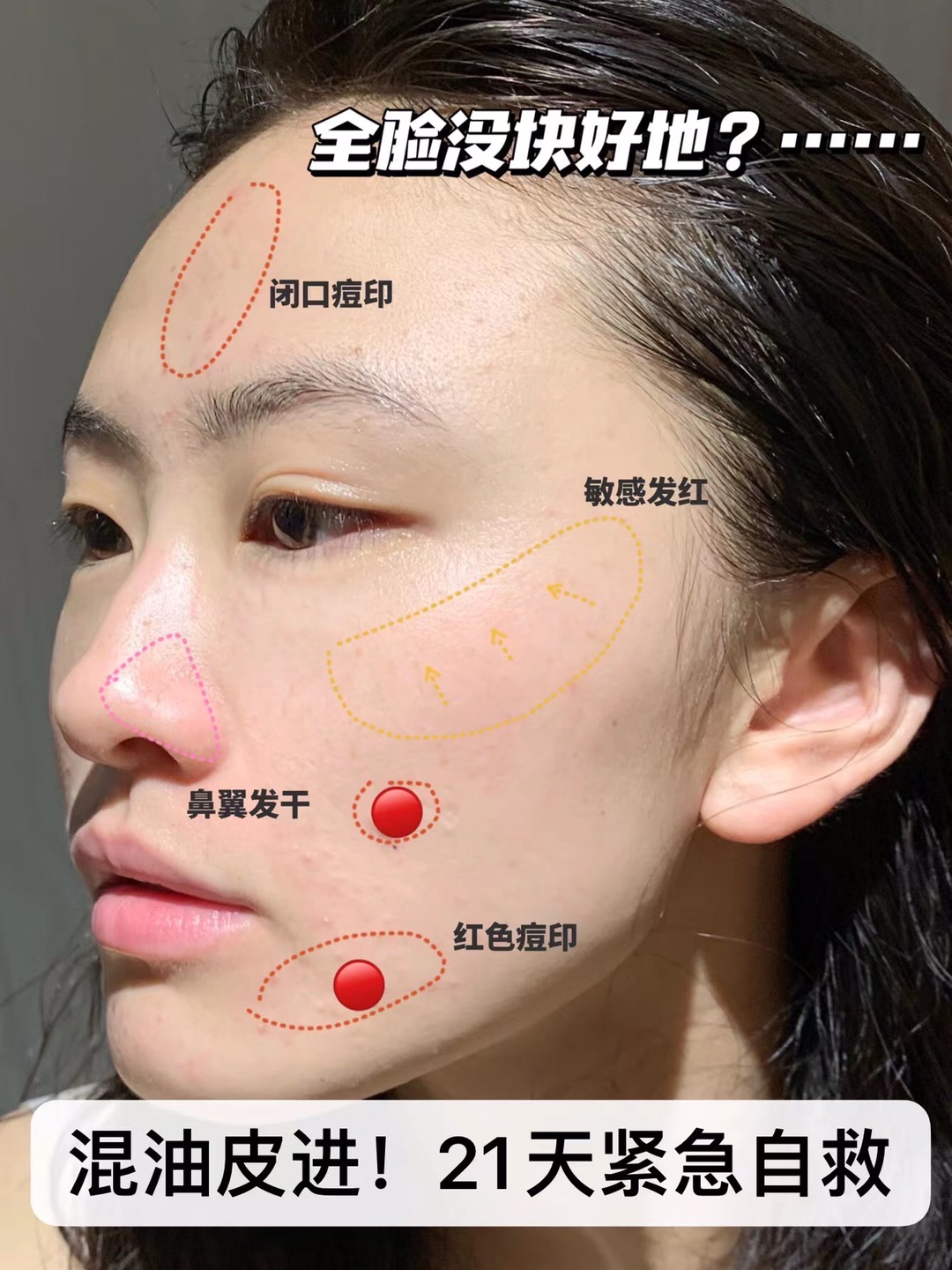 修护届的“作弊神器”！早点用也不至于反复烂脸🤬！