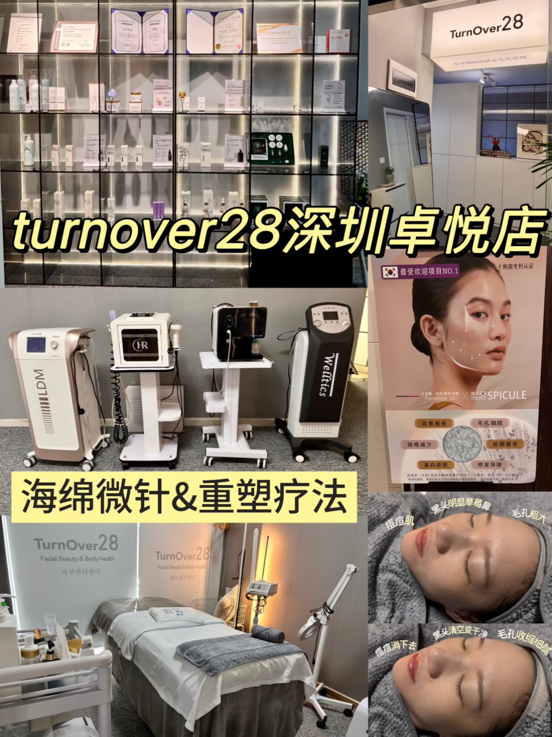 微针选择“水解海绵微针”更安全✅亲测有效