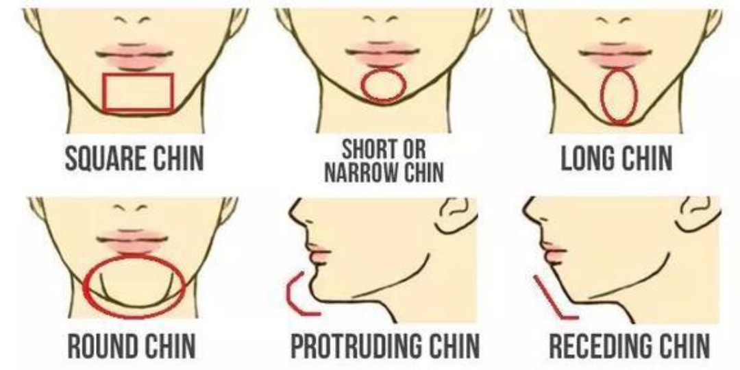 下巴的六种类型