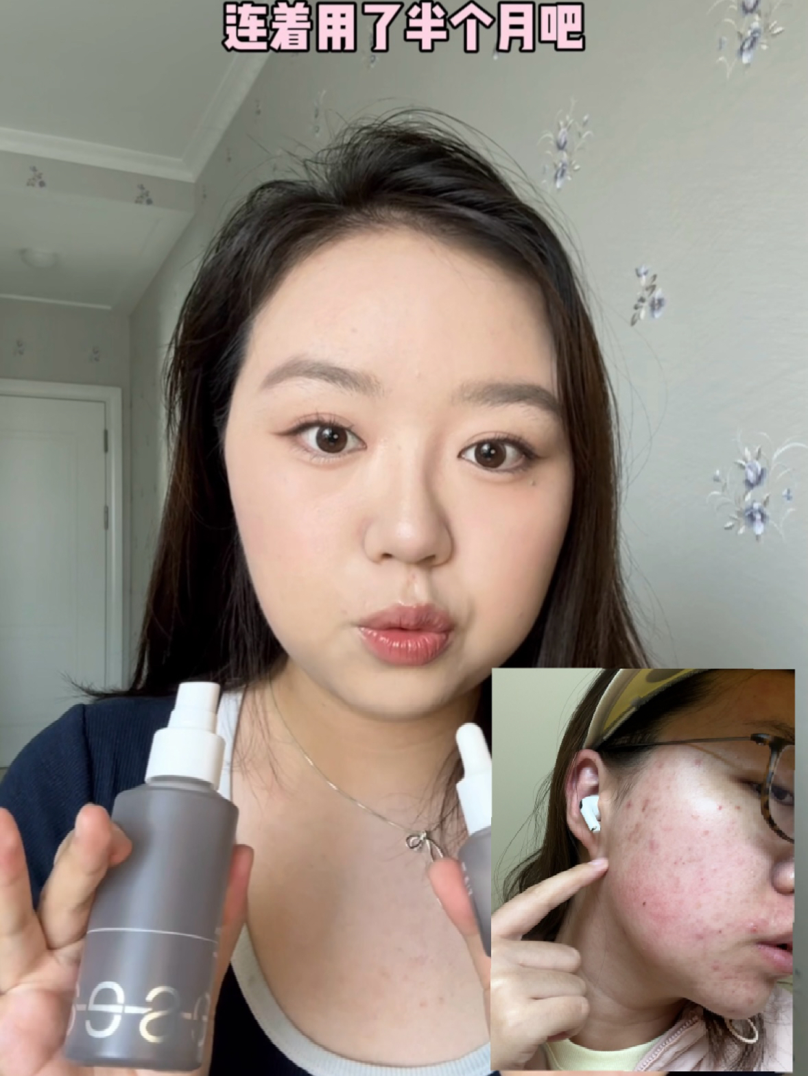 b5精华=水果里的苹果🍎干敏肌夏季必备精华