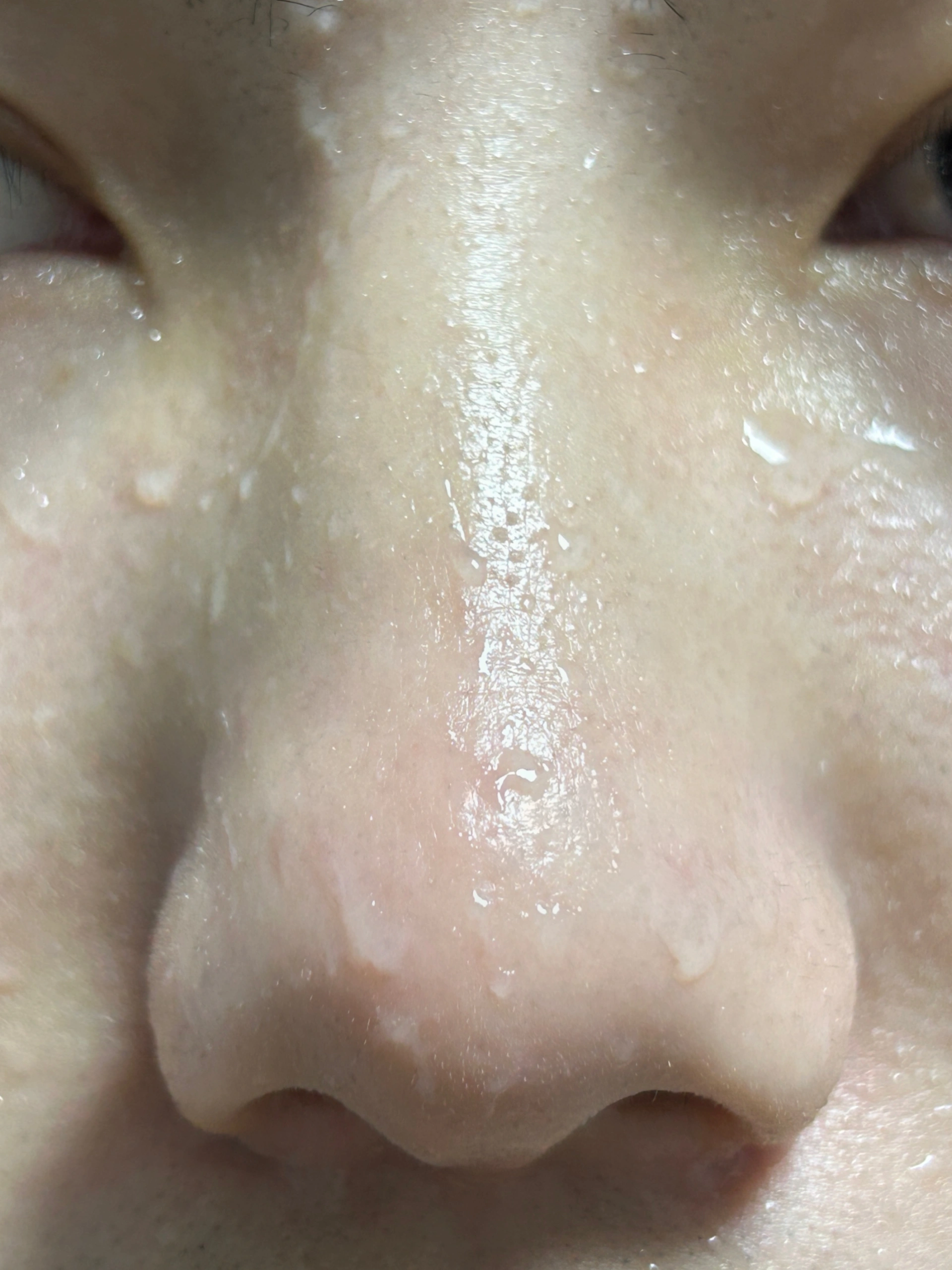 洗澡时去黑头zei厉害的法子...