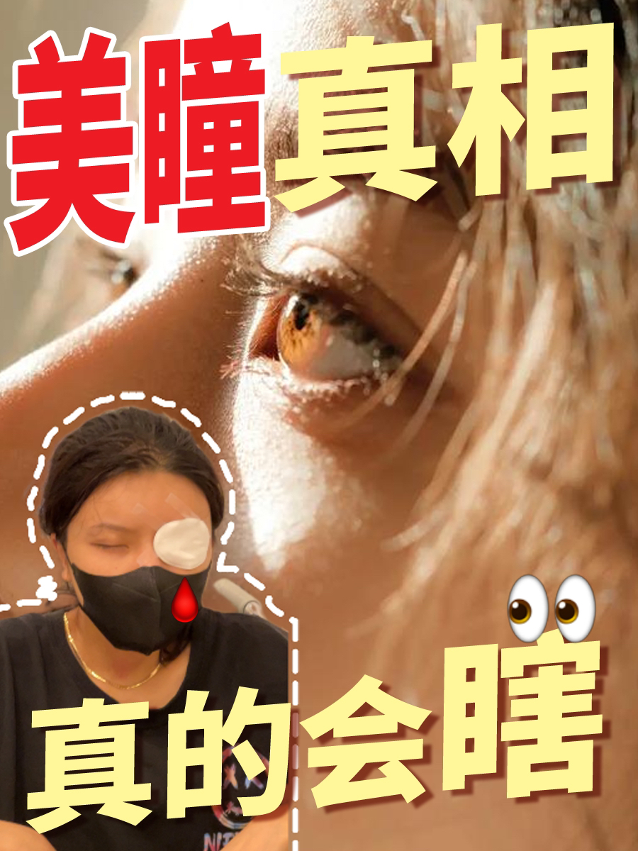 我差点就瞎了眼‼️还好了解到全光塑黑科技