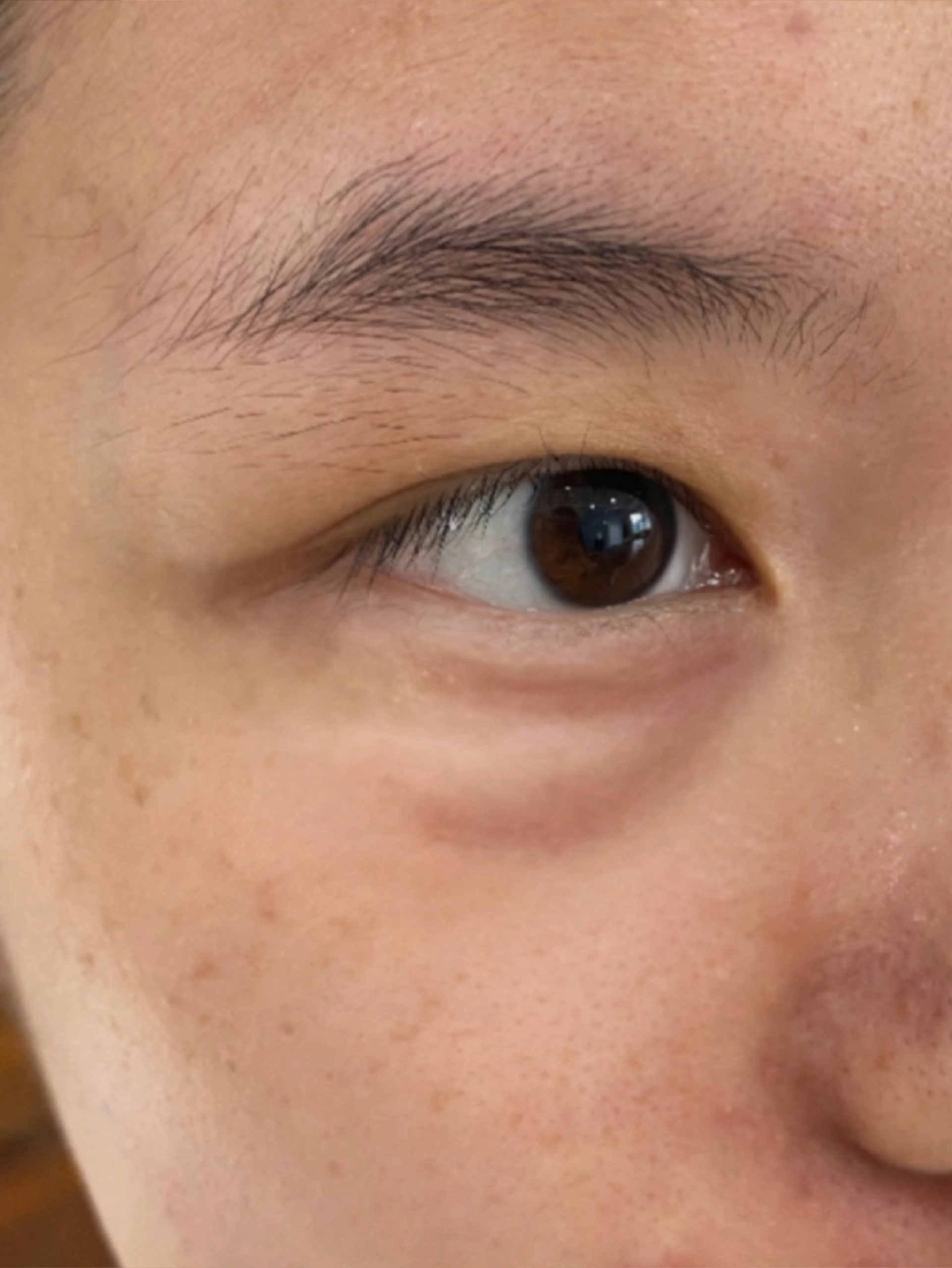 眼下有眼袋别再遮了！一篇教你上岸