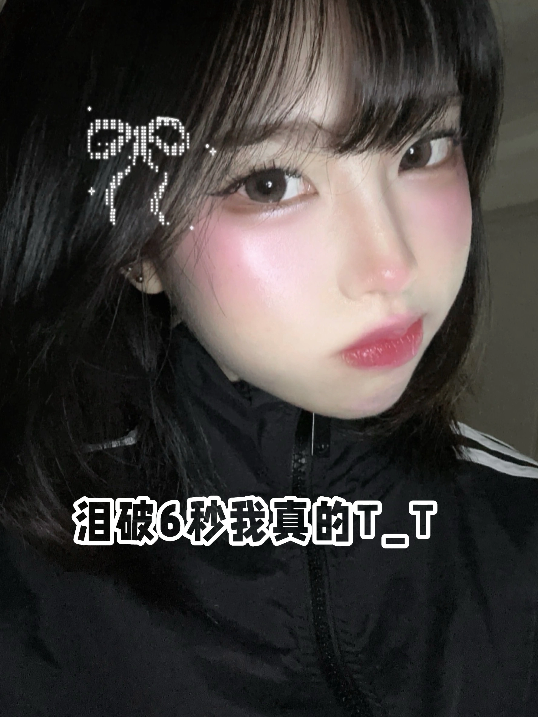 泪膜破裂时间6秒能做广州近视手术？
