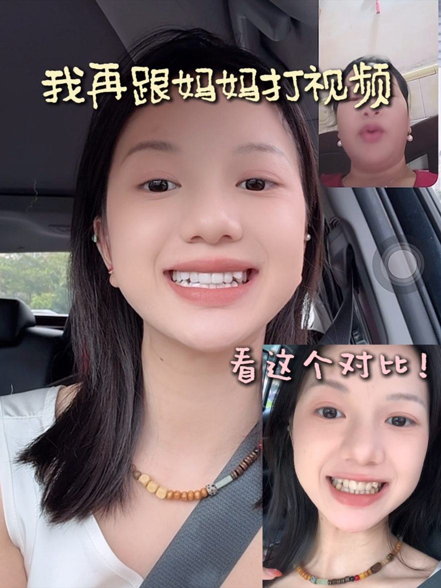 一个坏消息：主包再也不能测评美白牙膏了😭