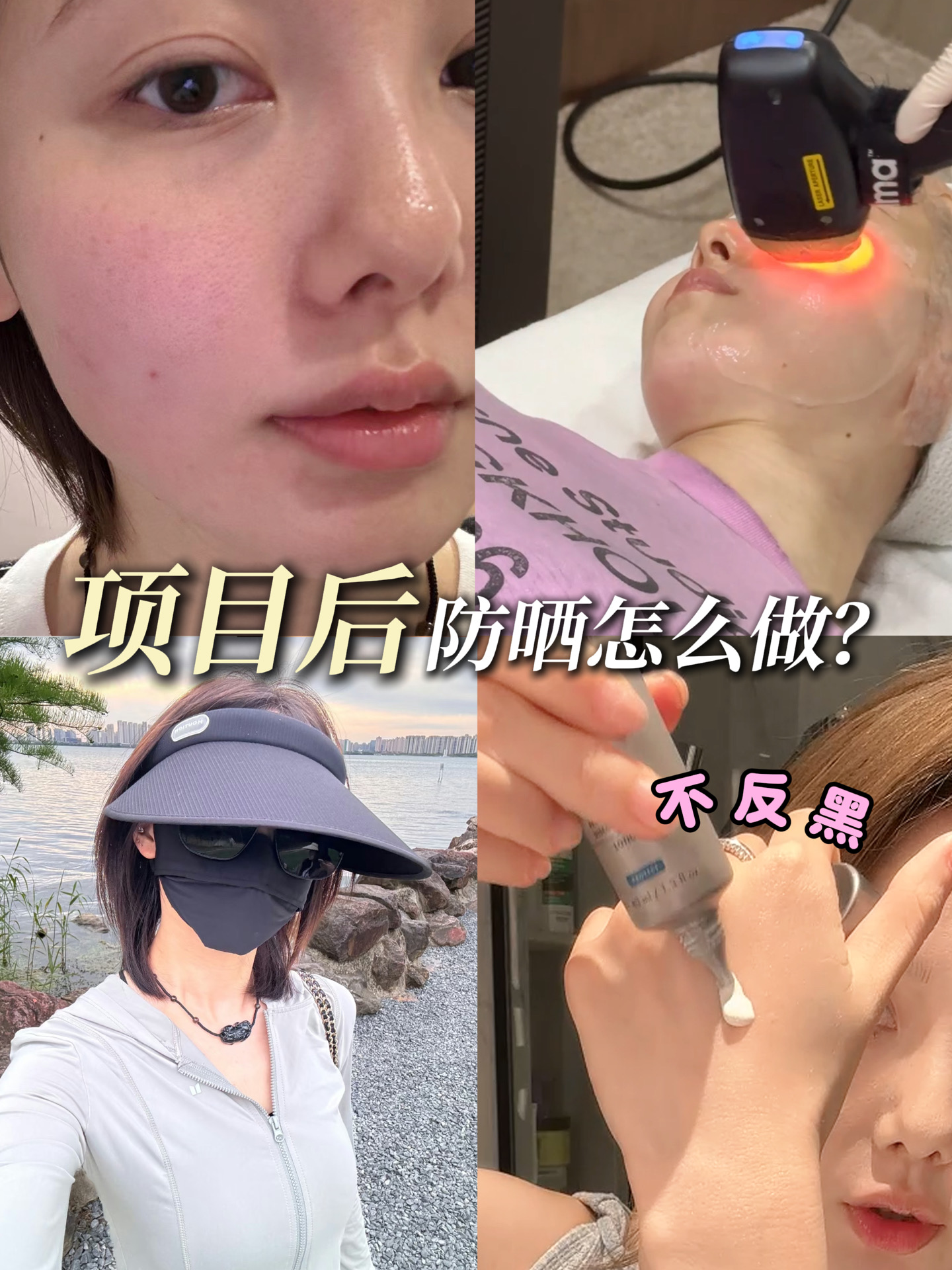 DO后防晒指南，美女不花一分冤枉钱！