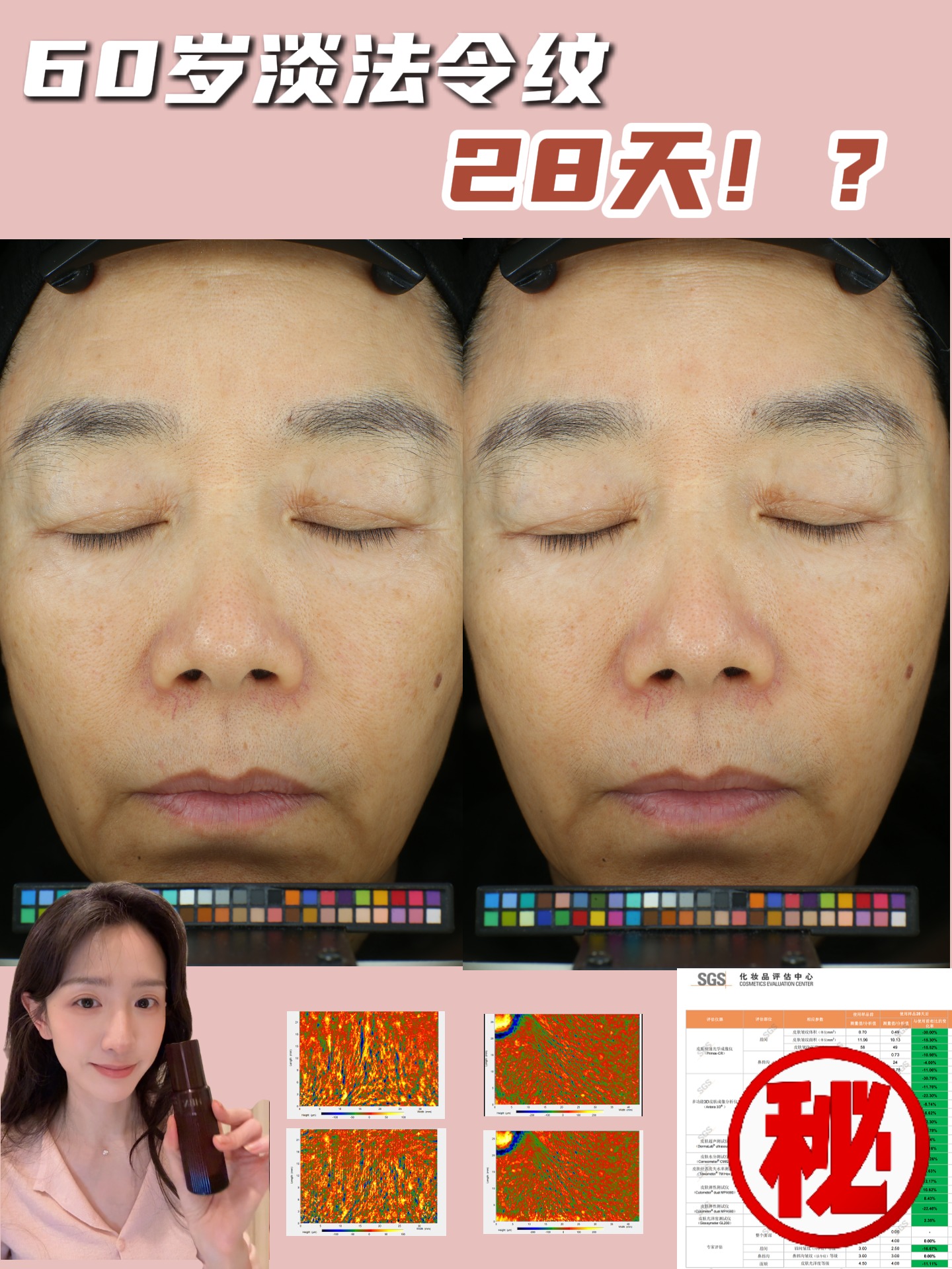 我妈的法令纹也淡了！！不do脸年轻五岁！