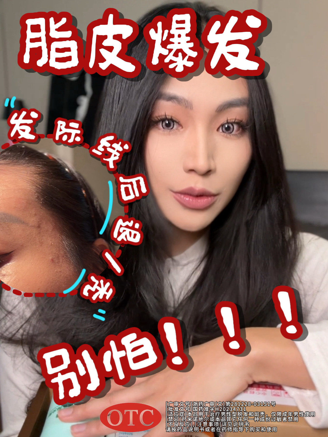 脂皮爆发/掉发 先别慌！按步处理！！