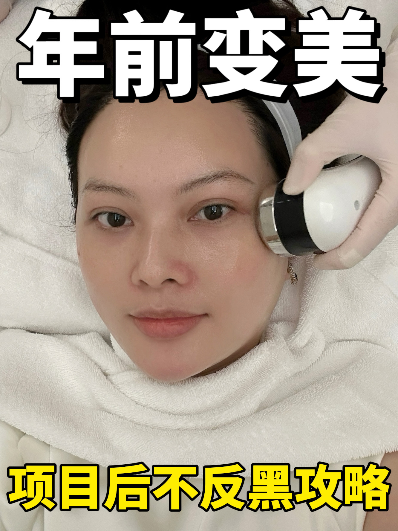 过年冲项目变美？90%的人栽在最后这一步