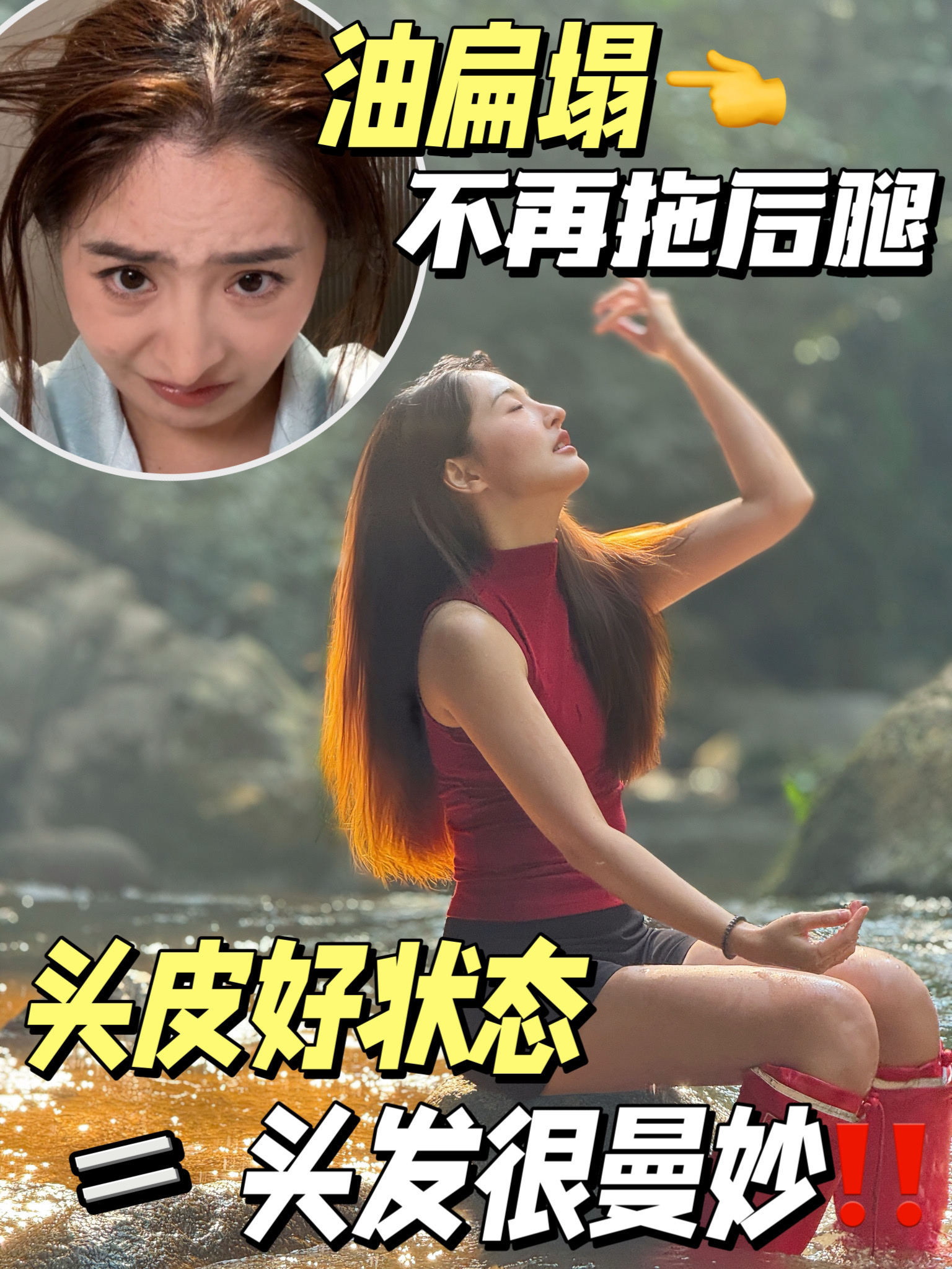 用养脸皮的方式养头皮‼️“油扁塌”真的886