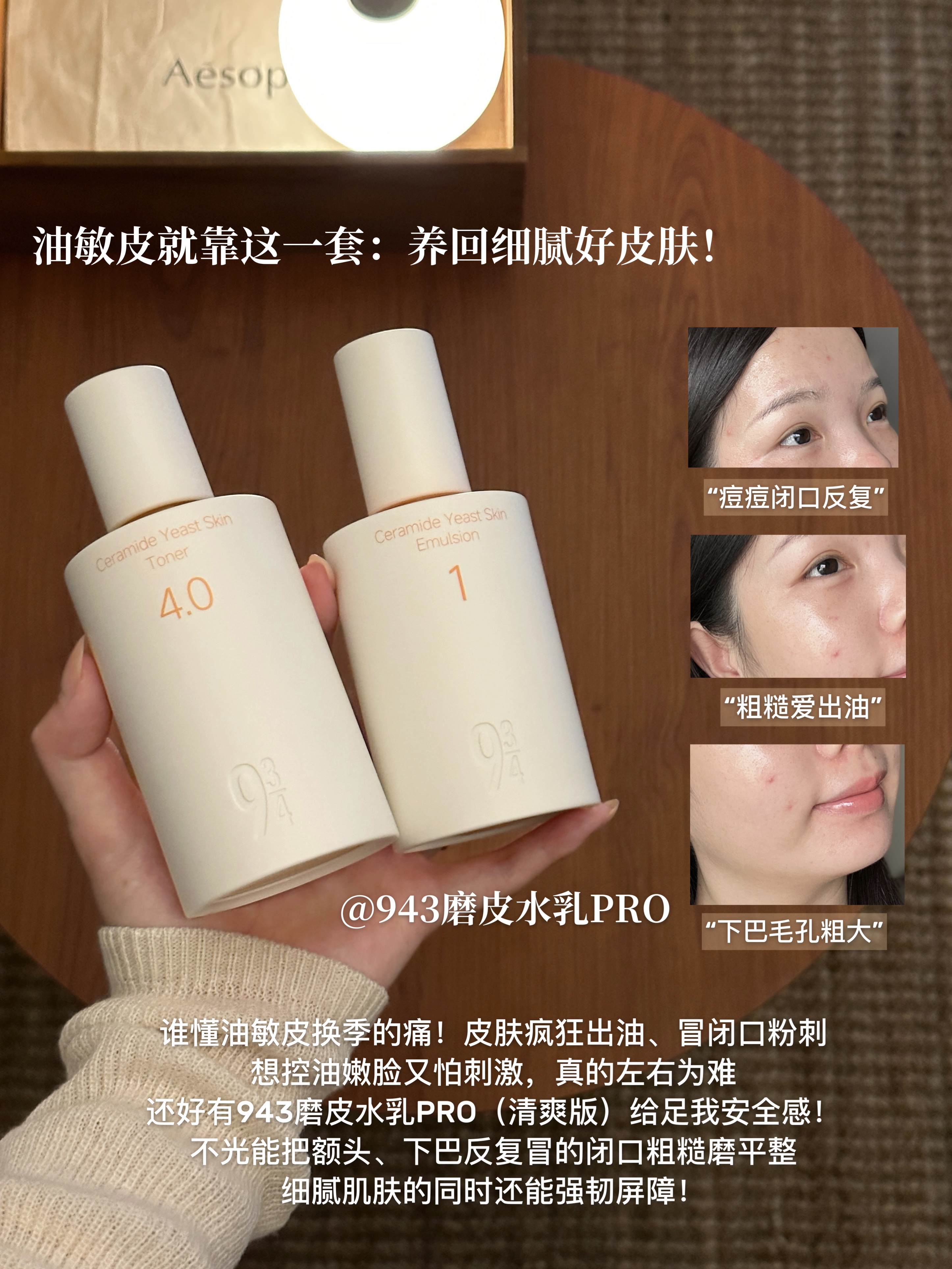 油敏皮人生水乳！7天搞定闭口抚平粗糙感！