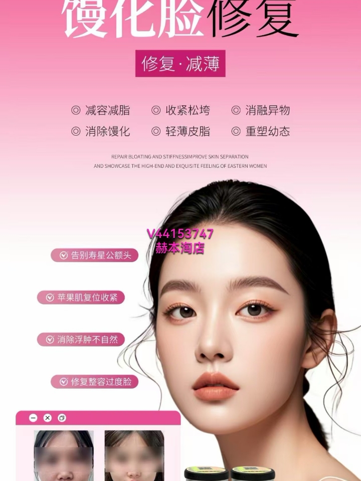面部臃肿馒化、软组织下垂真的拉低颜值！贴骨针立体精修，消融多余堆积、轻薄皮脂，收紧全脸松垮，复位苹果肌，告别假面老态，紧致幼态常驻✅#韩卡琪#