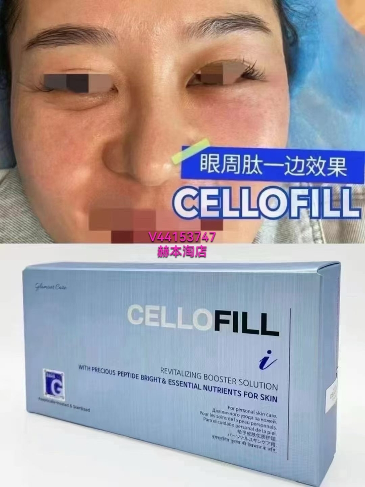 赛罗菲眼周肽  品牌：𝐂𝐄𝐋𝐋𝐎𝐅𝐈𝐋𝐋 规格:   2ml*6瓶   成分：AG-lock技术   IntoCell-Stn1  / IntoCell-Sirtuin 1，2/ IntoCell-GD F11/ 多种生物化学肽、谷胱甘肽、48种氨基酸+矿物质+维生素复合物  功效: ✅黑眼圈细纹 ✅上眼睑提升✅眼底凹陷