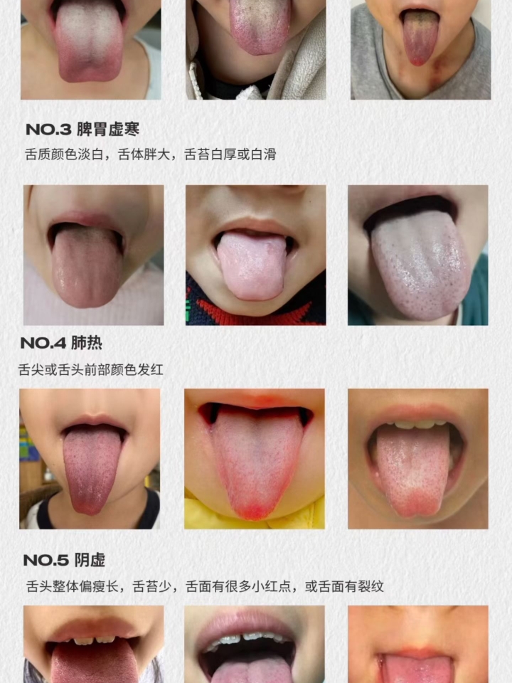 宝妈们可以对号入座，
看看自家娃属于哪类情况