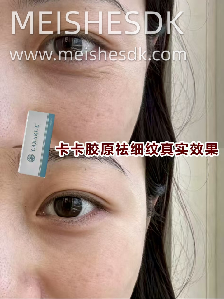 眼周抗衰｜卡卡 I 型胶原蛋白💛 柔软贴合眼部动态 柔光淡化黑眼圈 支撑 + 胶原新生双在线 持续代谢滋养，定格眼周年轻#韩卡琪#